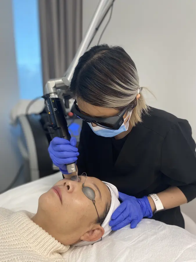 PicoSure laser treatment for pigmentation at Skin Art MD Burnaby